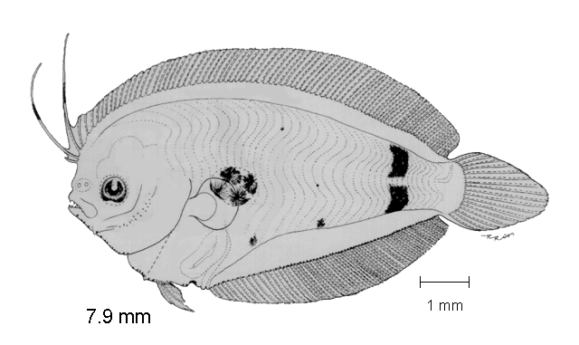 Citharichthys gilberti